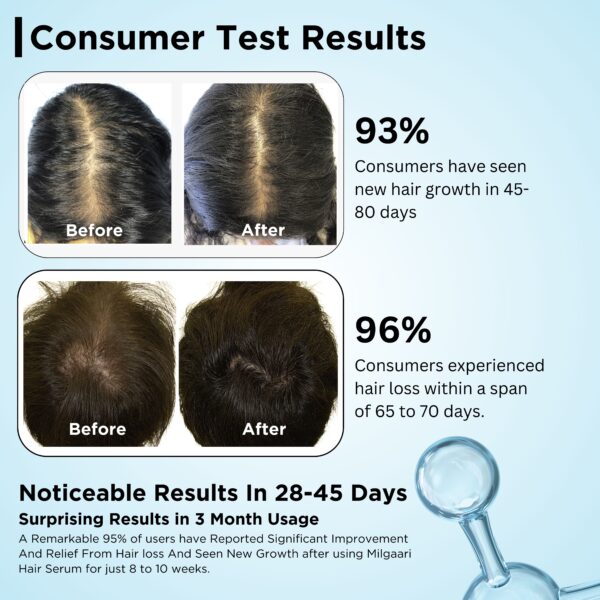 European Rosemary Hair Growth Serum Result Pack 90ml - Image 4